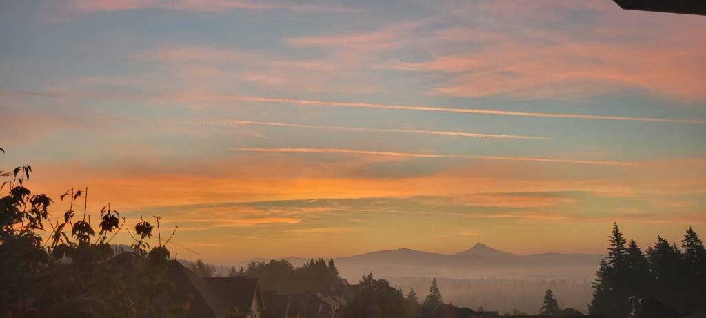 Botox para el&nbsp;cerebro